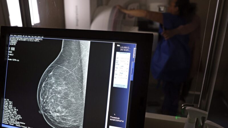 Nova lei reforça direito a três folgas por ano para exames preventivos