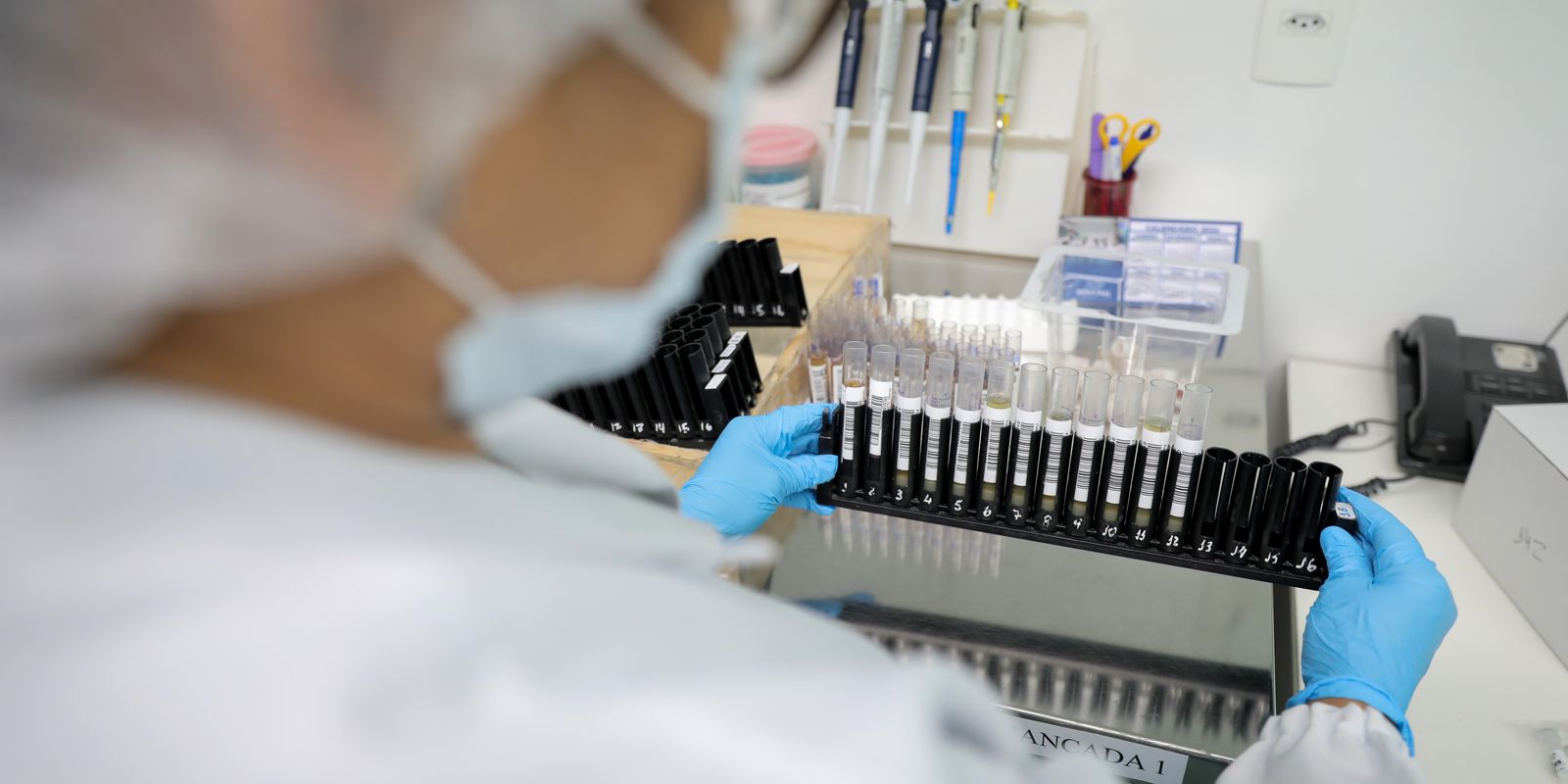 fiocruz-obtem-patente-para-tratamento-contra-malaria-resistente