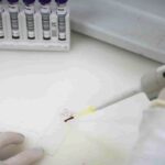 exames-descartam-ebola-em-imigrante-da-republica-democratica-do-congo