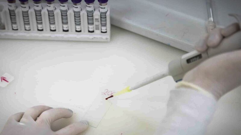 Exames descartam ebola em imigrante da República Democrática do Congo