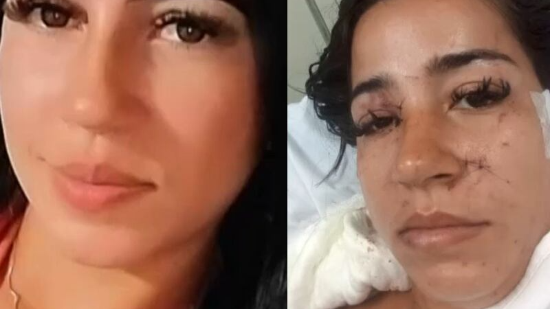 Mulher é atacada com mais de 30 facadas por ex-sogra e ex-amante do marido – Folha de Dourados – Notícias de Dourados-MS e região