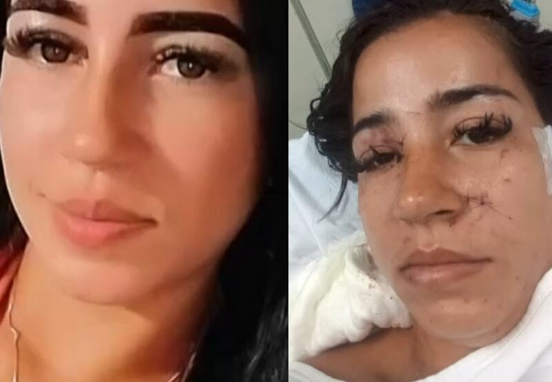 Mulher é atacada com mais de 30 facadas por ex-sogra e ex-amante do marido – Folha de Dourados – Notícias de Dourados-MS e região