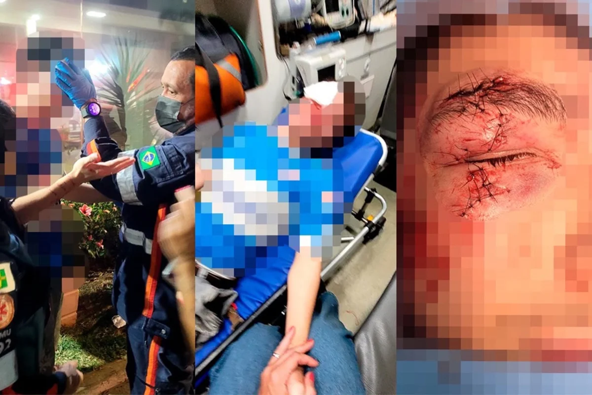 morador-de-rua-desfigura-rosto-de-jovem-e-e-solto-no-mesmo-dia-–-folha-de-dourados-–-noticias-de-dourados-ms-e-regiao